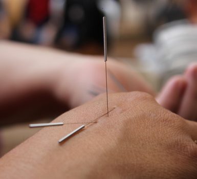 2026 – Das Jahr der Akupunkturpunkte